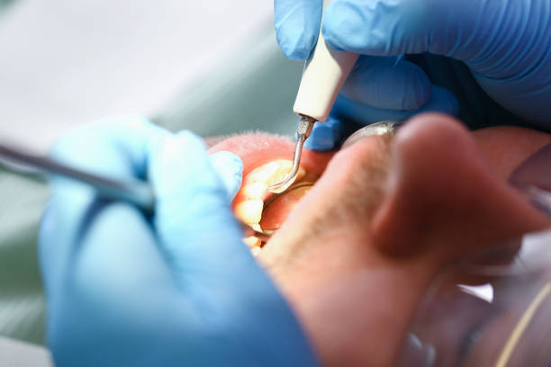 Best Emergency Treatment for Toothache in Harlem, FL